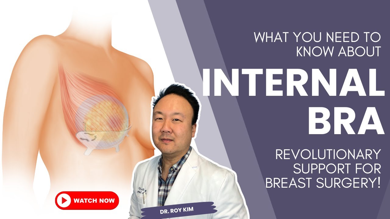 Internal Bra Complications? You Have Legal Options